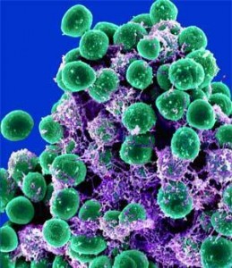 staphylococcus_epidermidis