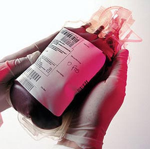 تحقیق درباره خطرات ناشی از لوکوسیت در هنگام تزریق خون